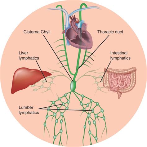 Chylous Ascites: A Review of Pathogenesis, Diagnosis and Treatment