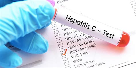 Hepatitis C Virus (HCV) Test | Adventist HealthCare | Maryland