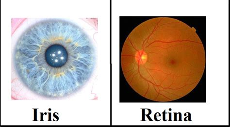 Iris Recognition vs. Retina Scanning — What are the Differences?