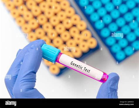 Oncogene test, cancer cell detection test result with blood sample in test tube on doctor hand ...