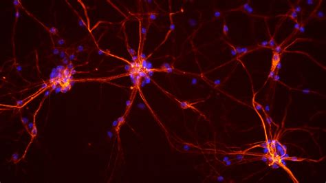 New Study Finds a Single Neuron Is a Surprisingly Complex Little Computer