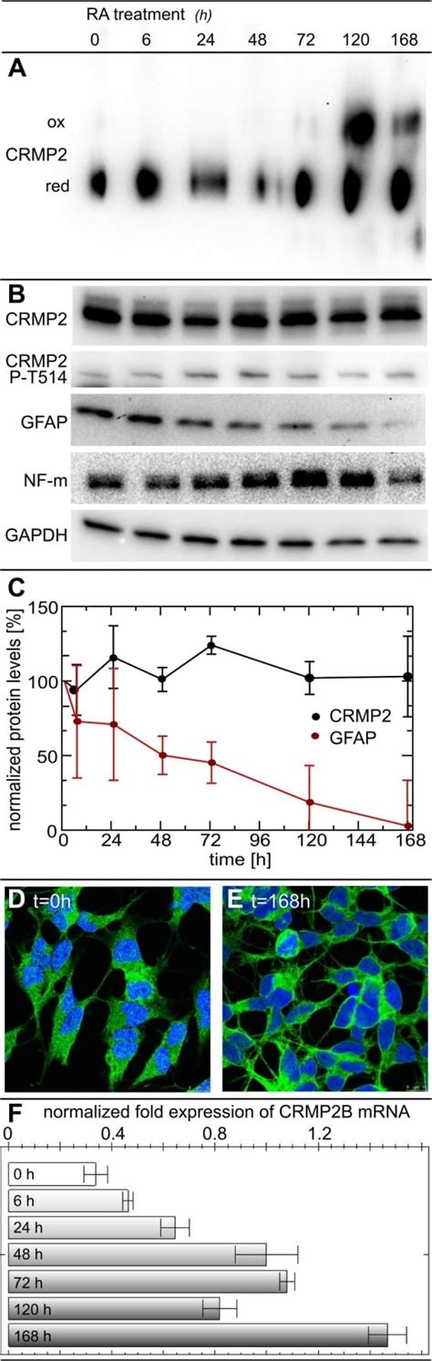 GFAP Antibody (PA3-16727)