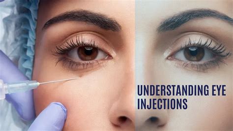 Understanding Eye Injections: A Comprehensive Guide