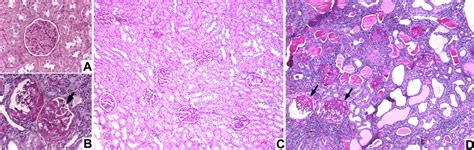 Renal PAS staining of 50-wk-old rats. At 50 wk of age, normal kidney... | Download Scientific ...