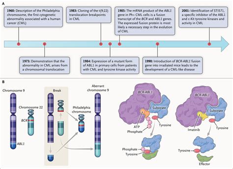 Philadelphia Chromosome–Positive Acute Lymphoblastic Leukemia | NEJM