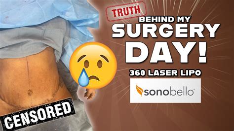 The Truth Behind My Surgery Day | Sono Bello Laser Lipo | Before and After | I CRIED !! - YouTube