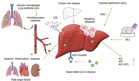 Liver disease and COVID-19: The link with oxidative stress, antioxidants and nutrition