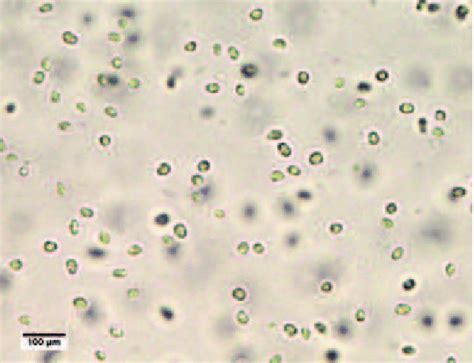 (color online) Chlorella vulgaris under light microscope with 10×... | Download Scientific Diagram