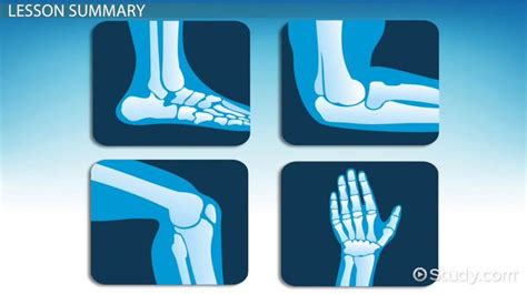 Hinge Joint | Types, Movement & Examples - Lesson | Study.com