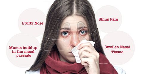 What is Nasal Congestion? | Words of Wisdom | Buckley’s