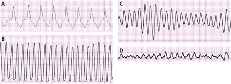 Pin auf Nursing Studies - cardiac