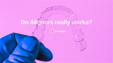 Do Clear Aligners Really Work