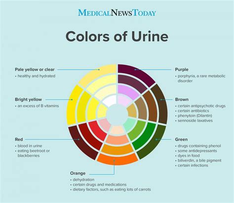 Bright yellow urine: Colors, changes, and causes | Color of urine ...