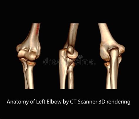 Anatomy of Left Elbow by CT Scanner 3D Rendering Image. Stock Illustration - Illustration of ...