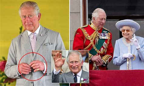 Doctor reveals why King Charles III's 'sausage fingers' are so swollen ...