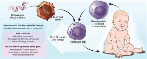 Gene Therapy That Works | Science