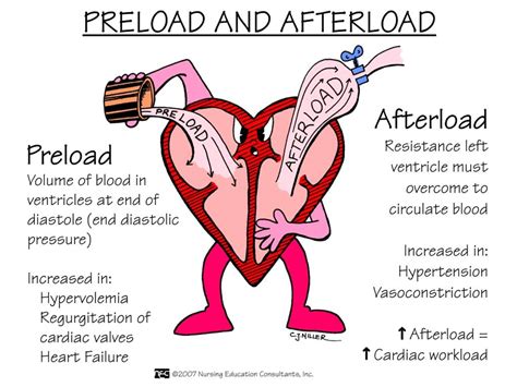 Nursing Mnemonics: Preload vs Afterload - StudyPK