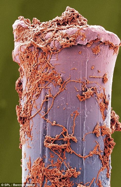 Scanning electron microscope (SEM) images show extreme close ups of plaque, incisors and decay ...