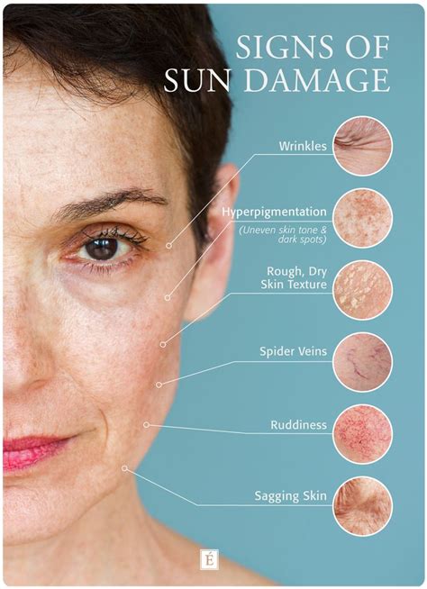 What Does Sun Damaged Skin Look Like? | Eminence organic skin care, Sun damaged skin, Sagging skin