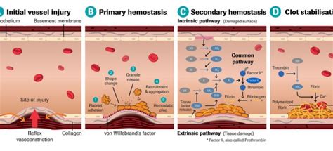 Thrombophilia – causes and symptoms. Types of thrombophilia – Healthy Food Near Me