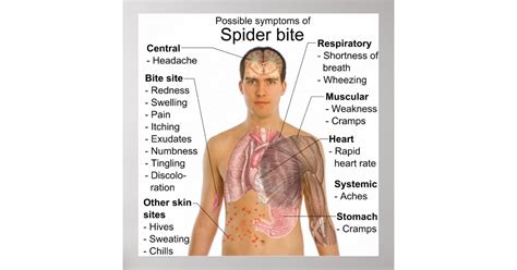 Symptoms Common in Poisonous Spider Bites Chart | Zazzle.com.au