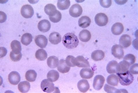 Free picture: micrograph, mature, immature, plasmodium vivax, schizont