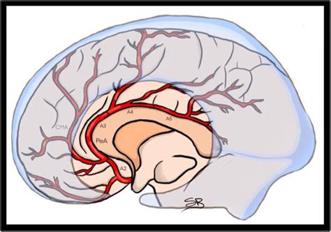 Anatomy of the distal anterior cerebral artery and relationship with... | Download Scientific ...