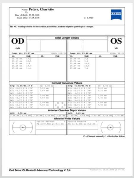 Zeiss IOL Master V5 Biometry A Scan – My Eye Equipment