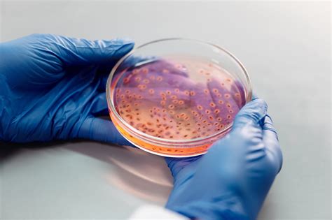 Bacterial Colony Morphology- Complete Guide