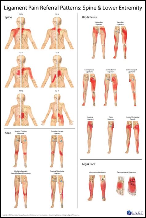 Ligament Pain Referral Patterns #PsoasPain | Physical therapy, Massage therapy, Trigger points