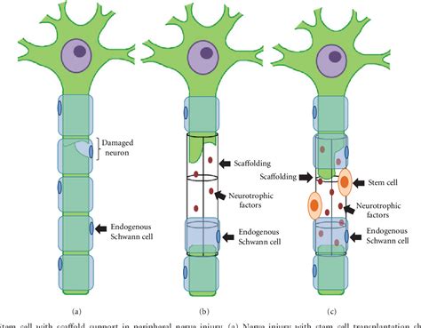 Figure 1 from Peripheral Nerve Repair with Cultured Schwann Cells: Getting Closer to the Clinics ...