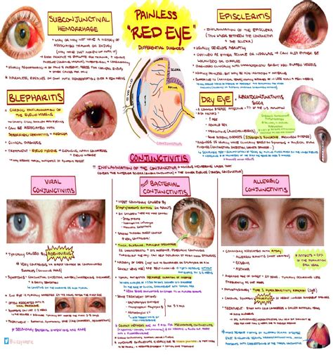 The Red Eye - Emergency Medicine Kenya Foundation