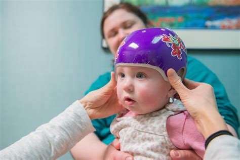 Custom-Made Baby Helmets for Flat Head Syndrome | Gillette Children's