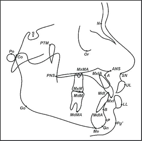 Cephalometric Landmarks Focus Dentistry, 58% OFF