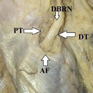 Patient with unilateral juvenile hypertrophy of the breast. (Upper raw)... | Download Scientific ...