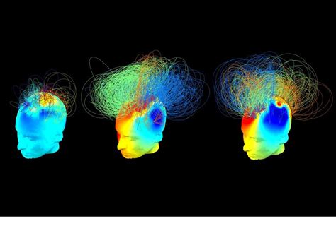 New technique helps find hidden consciousness in coma patients -- Science of the Spirit -- Sott.net