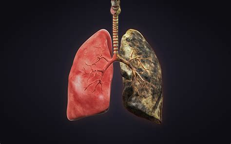 Smokers’ Lungs vs Healthy Lungs: Know the Difference ...