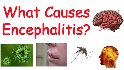 Encephalitis Lethargica Cause Symptoms Diagnosis