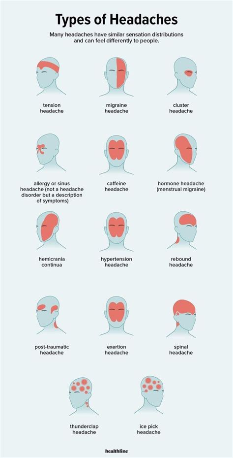 Types of headaches : r/coolguides