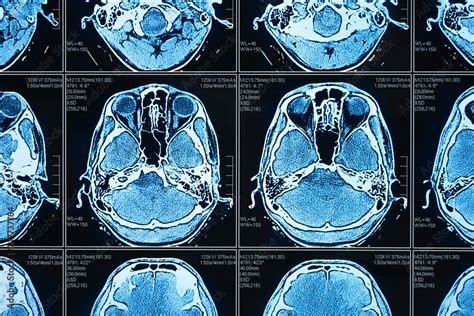 Artificial intelligence in smart healthcare hospital technology concept ...