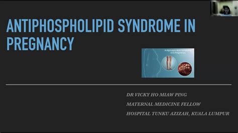 Antiphospholipid syndrome in pregnancy - YouTube