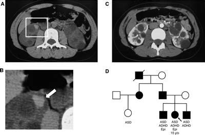 Frontiers | Case Report: Guanfacine and methylphenidate improved chronic lower back pain in ...