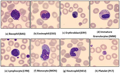 Diagnostics | Free Full-Text | BCNet: A Deep Learning Computer-Aided Diagnosis Framework for ...