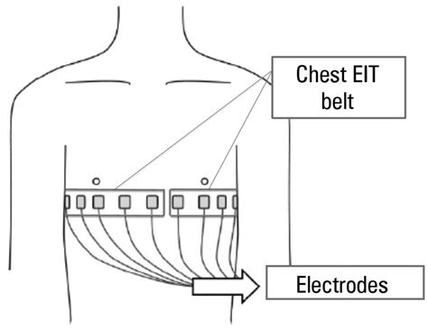 Positioning of the electrodes for thoracic electrical impedance ...