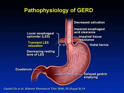 Esophagus. Esophageal Structure - презентация онлайн