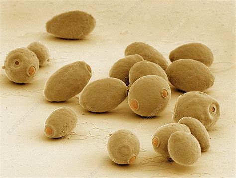 Baker's yeast, SEM - Stock Image - C022/2893 - Science Photo Library