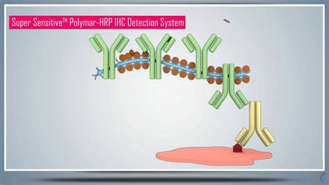 Immunohistochemistry (IHC) – Principle, Technique and Protocol - YouTube