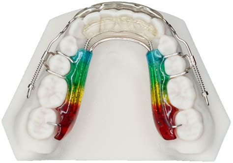 Inman Aligner Lower - Protec Dental