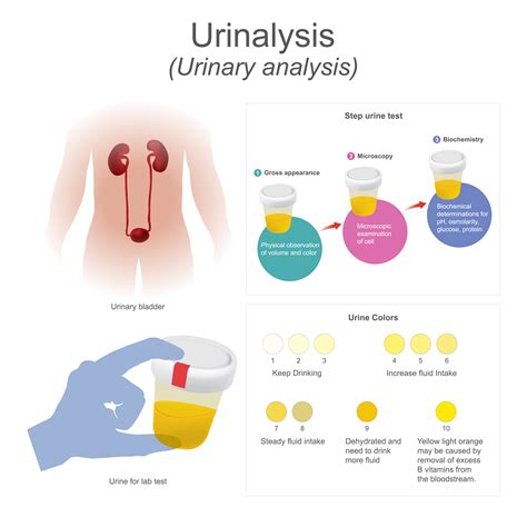 Urinalysis - Direct discounted blood work and lab testing - no doctor visit required