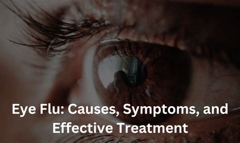 Eye Flu: Causes, Symptoms, and Effective Treatment